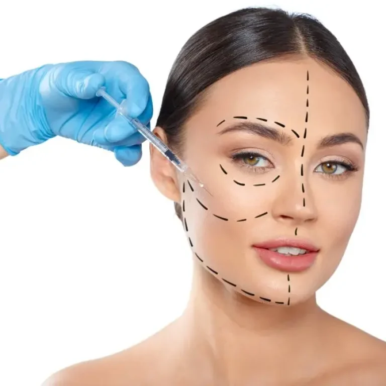 masseter-botoks-fiyatlari-3-min.jpg